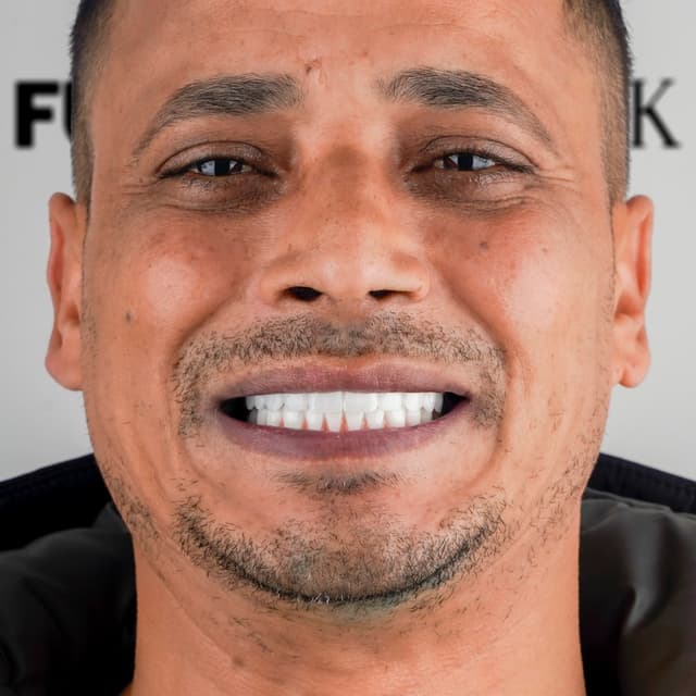 Smile 11
