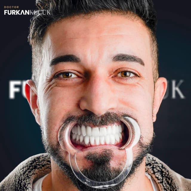 Smile 20